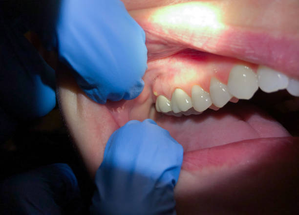  Bell Acres, PA Emergency Dentist Pros